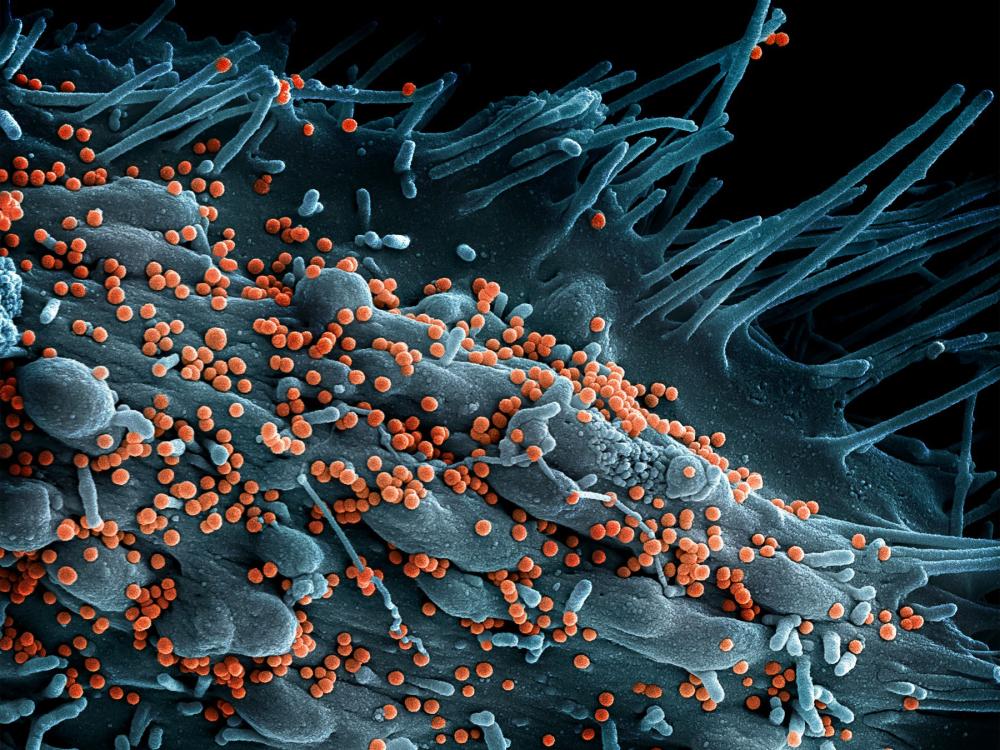 Lassa virus budding off an infected cell