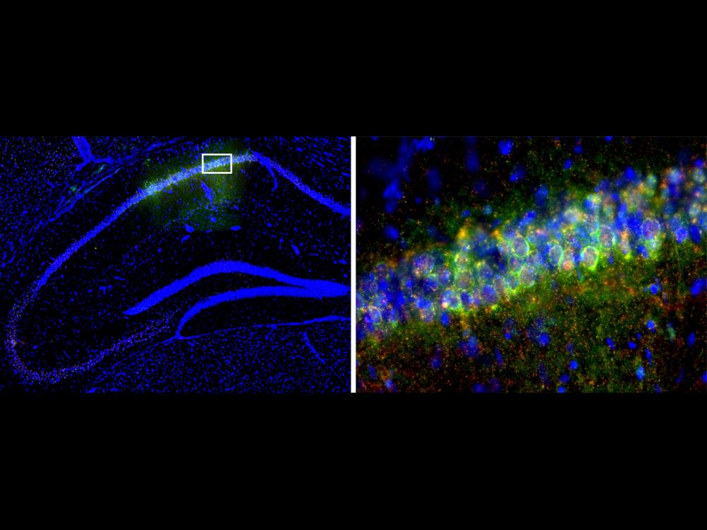 Flourescent staining of mouse dorsal hippocampus showing location of CRISPR expression