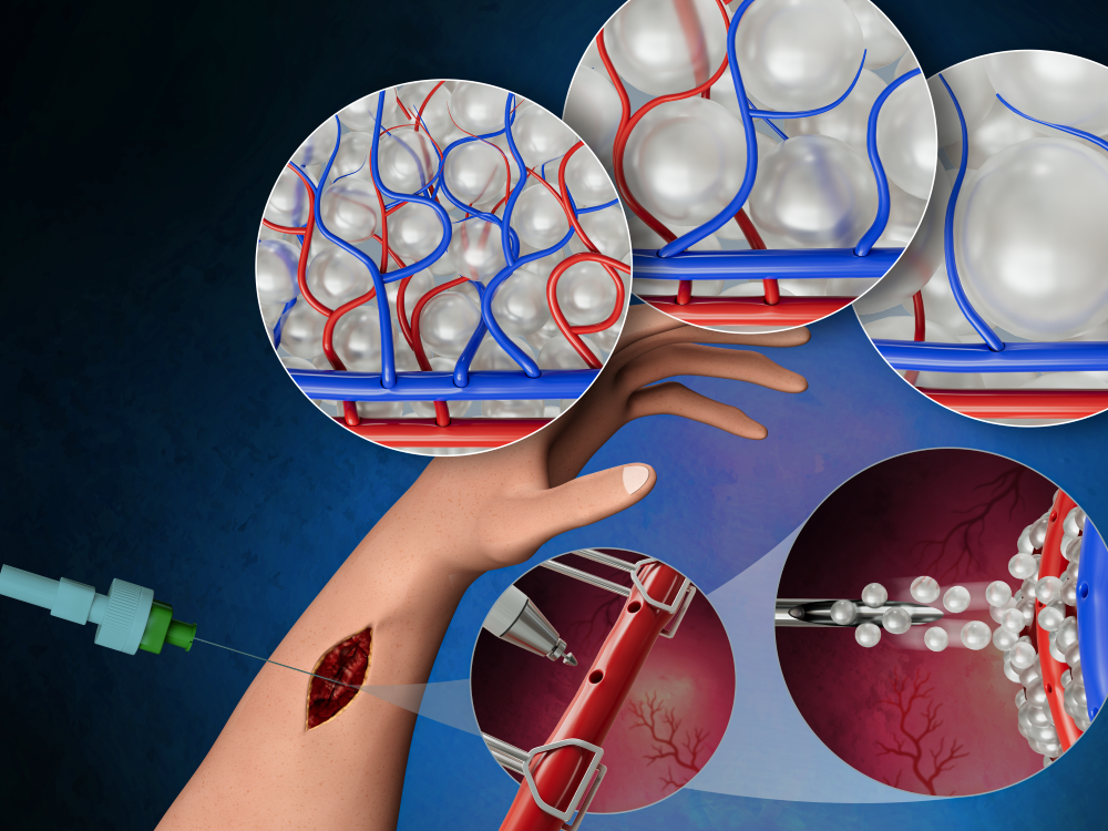 Stylized image showing how microsurgery and a biomaterial can improve tissue recovery