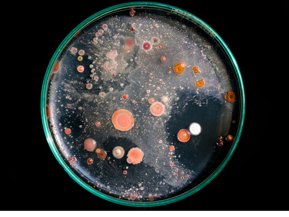 A petri dish