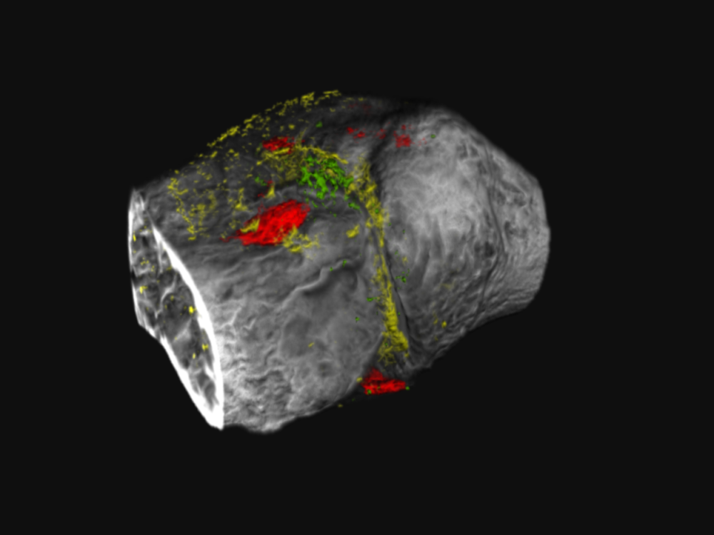 Image of gray bone with red, yellow and green visible