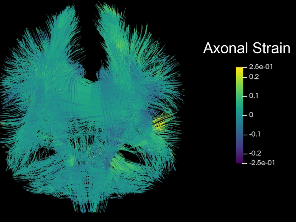 On a black background, a teal 3D visualization of axonal strain within the brain, showing the deformation experienced by axonal fibers due to a football impact.