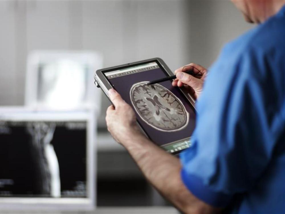 A healthcare professional in blue scrubs examines a brain scan on a digital tablet using a stylus.