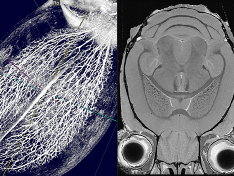Scans of a lychee seed and a mouse brain done in the Huck Institutes' High-Field Magnetic Resonance Imaging Facility