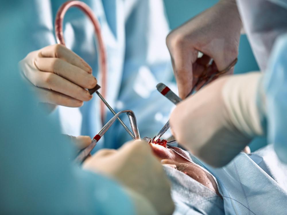Close up of a facial surgery