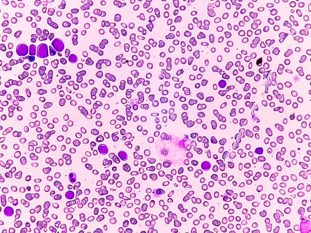 Microscopic image of pink and purple cells