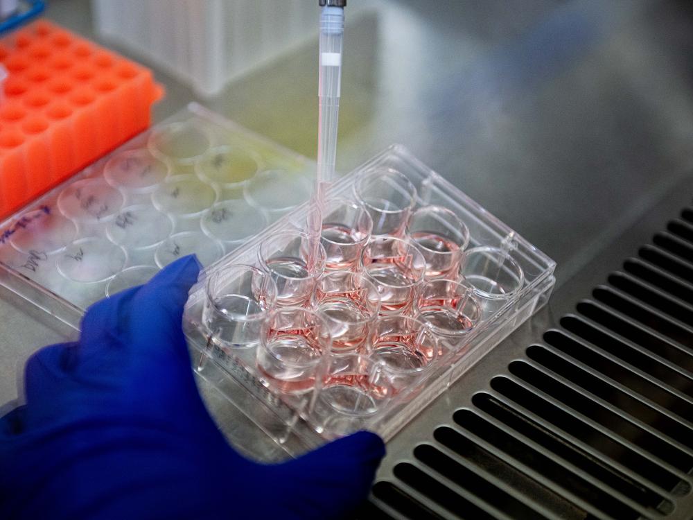 A gloved hand holds sterile containers