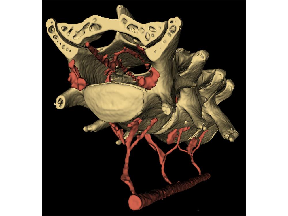 Cross-sectional image of spinal cord and veins