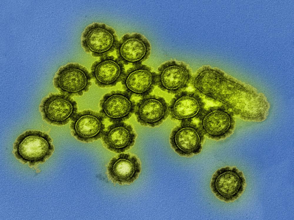 H1N1 influenza virus particles