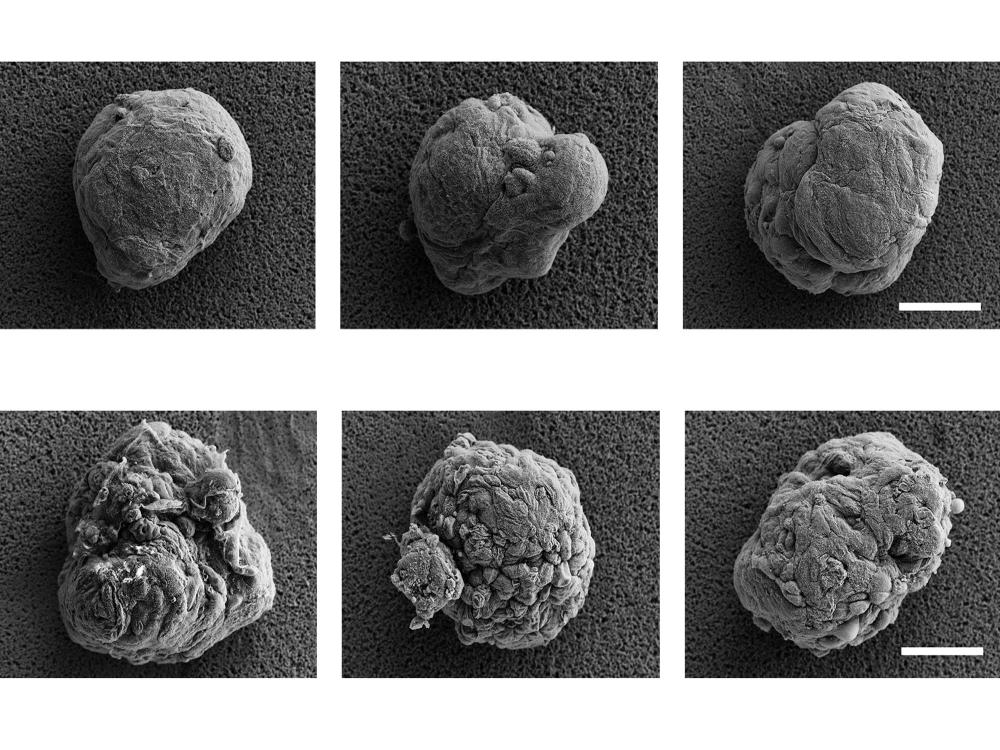 A researcher figure showing six microscopic images of cell clusters, or islets. The top three images show islets with a relatively smooth texture, while the bottom three images show cells with a rough texture as a result of the team's new research development