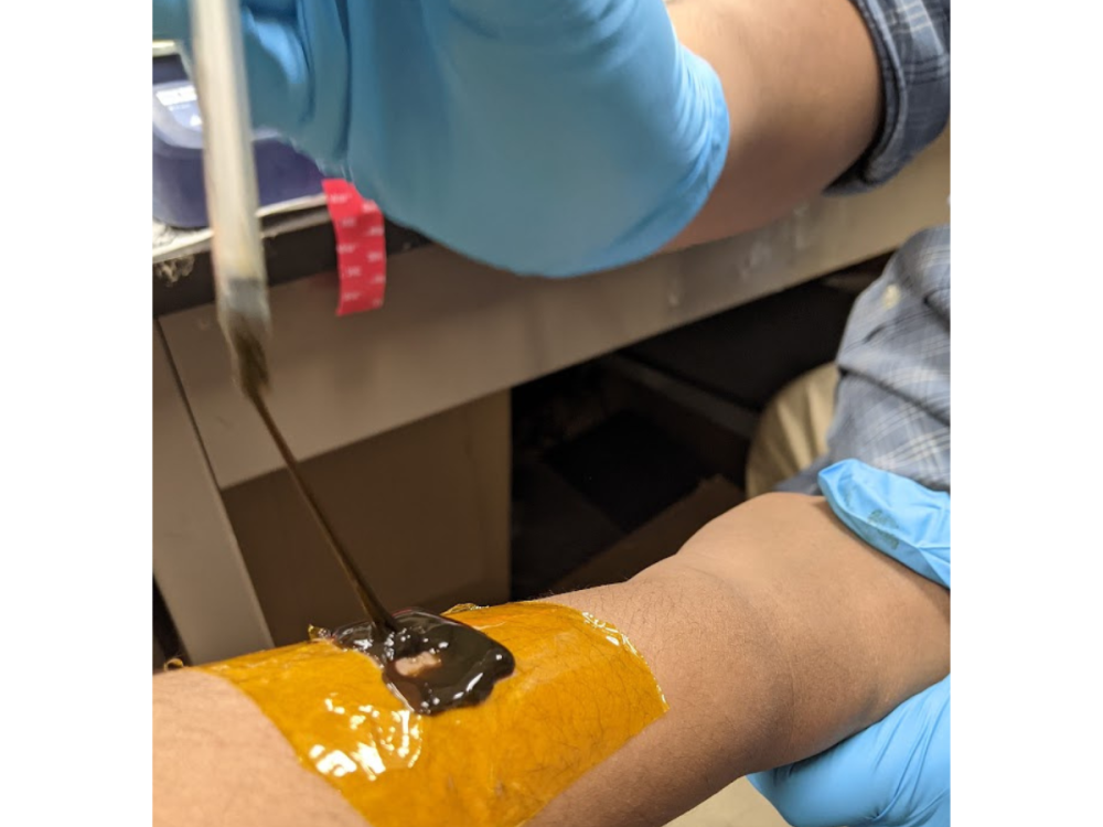 A researcher applies the printable RTLR hydrogel to a test participant’s skin.