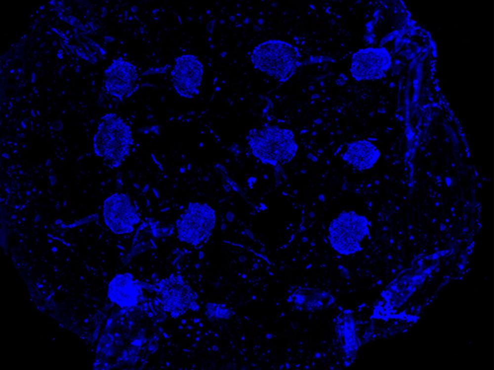 A research figure shows a photo of the team's spheroids arranged in a specific grid pattern inside of a microgel scaffold