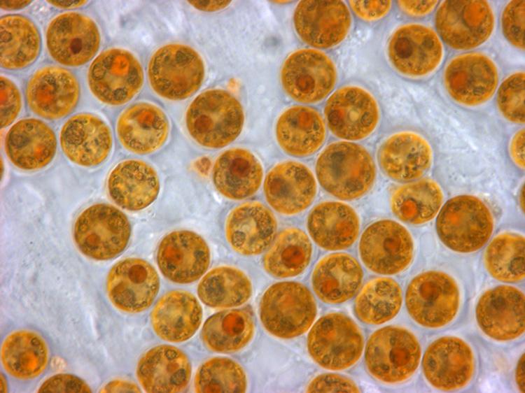 small circular golden-brown algae
