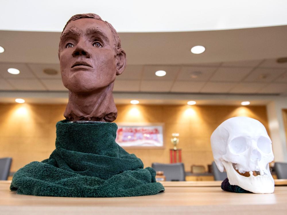 Kenyon facial reconstruction