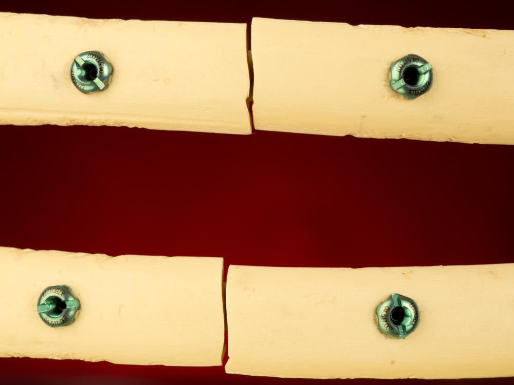 model of broken ribs with device attached