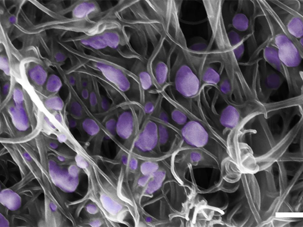 New, carbon-nanotube tool for ultra-sensitive virus detection and identification IMAGE 1