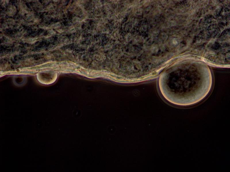 Oocyst in mosquito midgut.