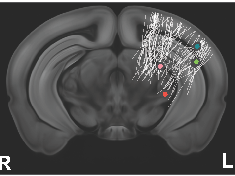 An x-ray image of a mouse brain, with diagonal lines labeled, as well as pink, green, and blue dots and the letters R and L. 