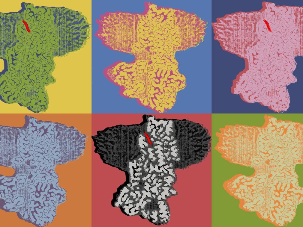 Illustrations of the ATP13A2 protein in six different color schemes. A handful of the illustrations show a narrow channel used for polyamine transport.  