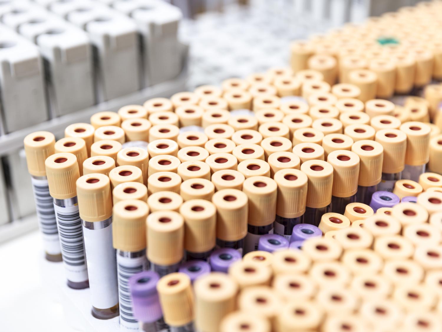 Test tubes in a tray