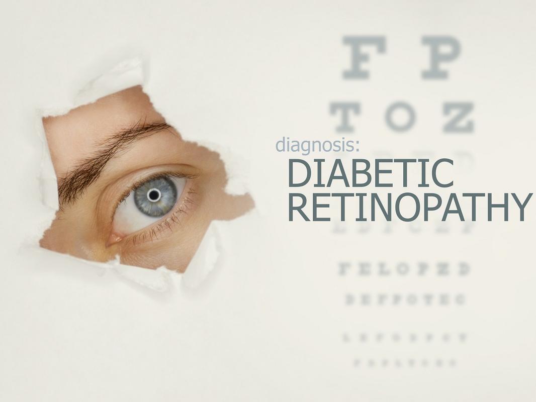 Woman’s eye looking through teared hole in paper, alongside an eye test with the words “Diabetic Retinopathy” on right.