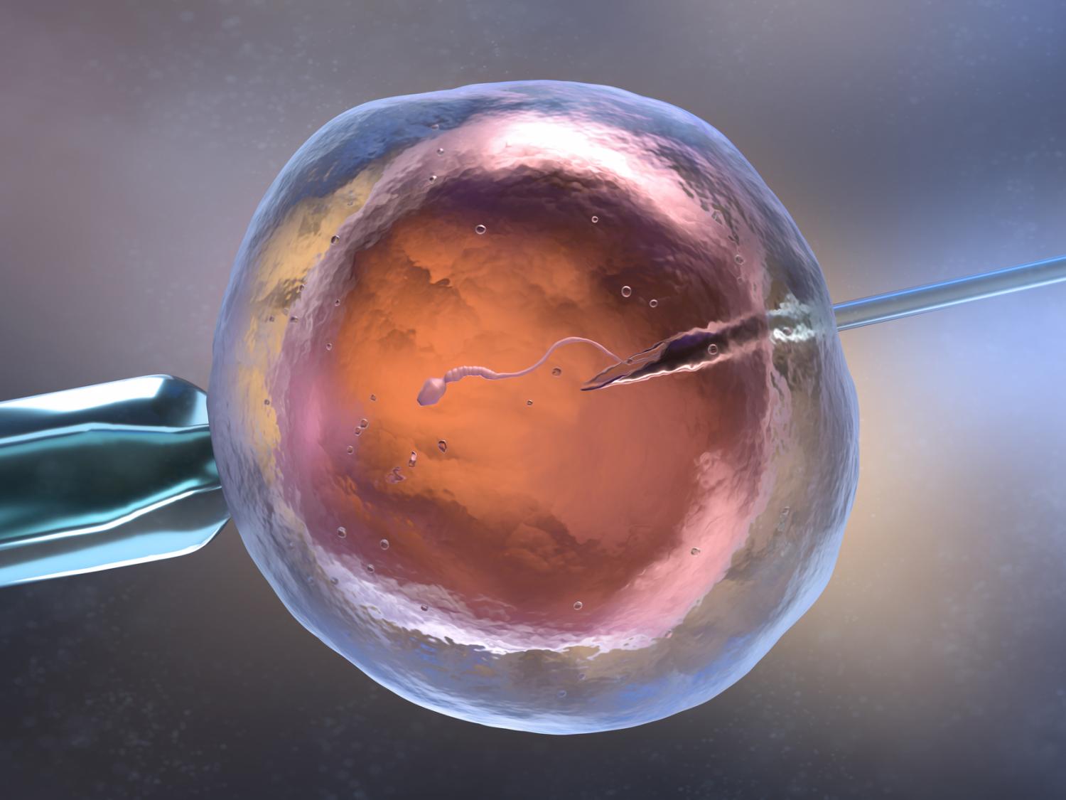 Injecting sperm into egg