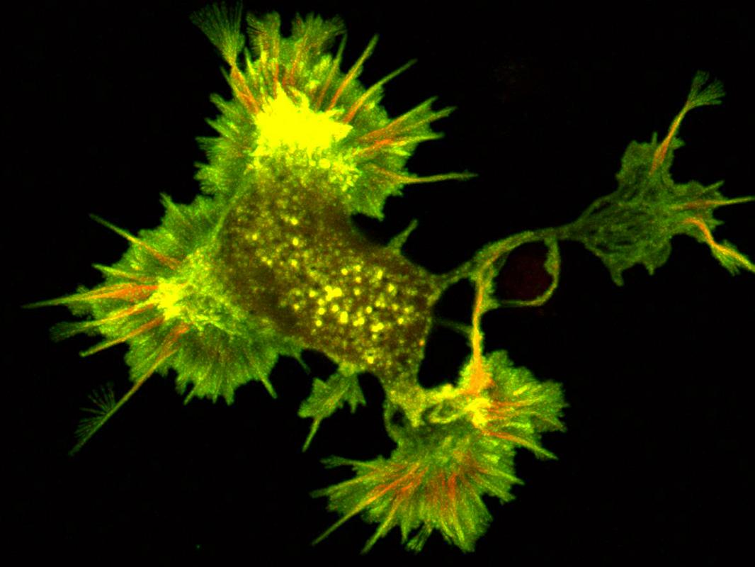 A whole, live cell image of a neuron expressing fluorescently tagged actin and cofilin.