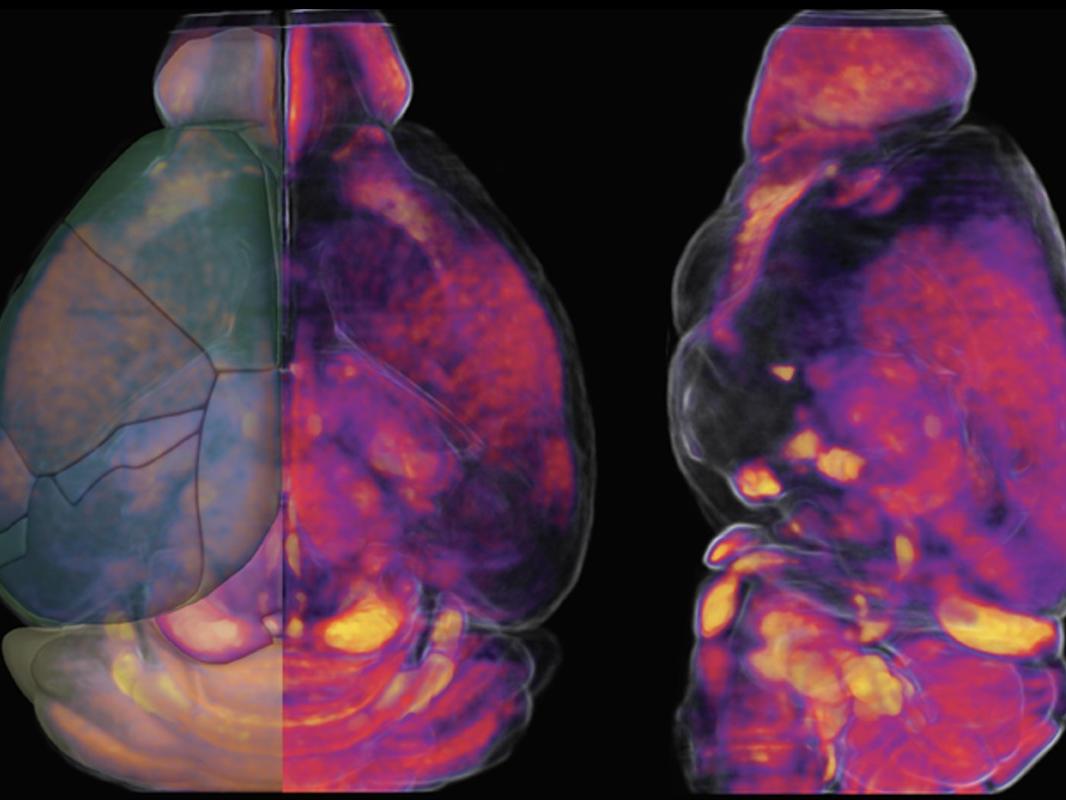 A scan of an adult mouse brain is shown from two different points of view. 