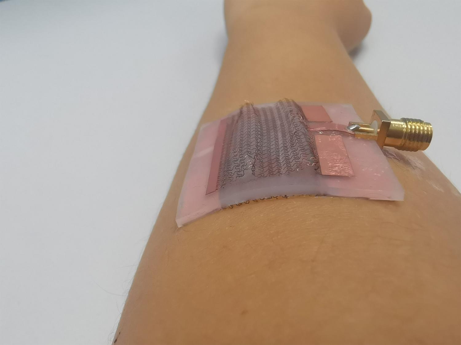 A electronic patch is shown on a human forearm.