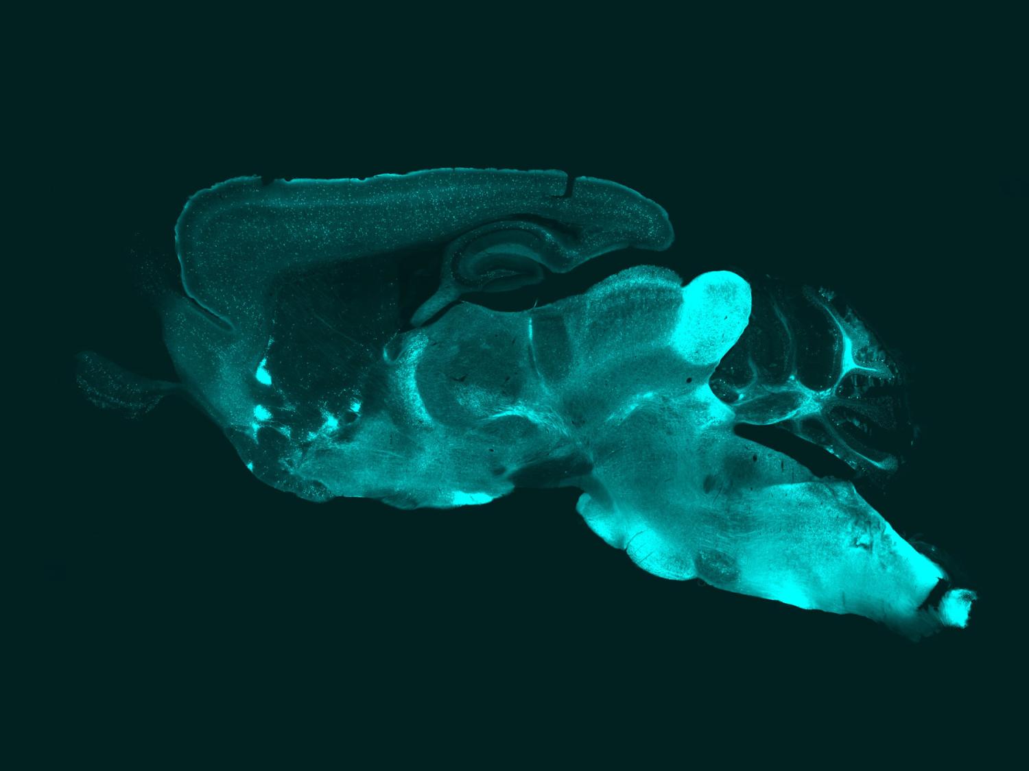 grayscale scan of mouse brain