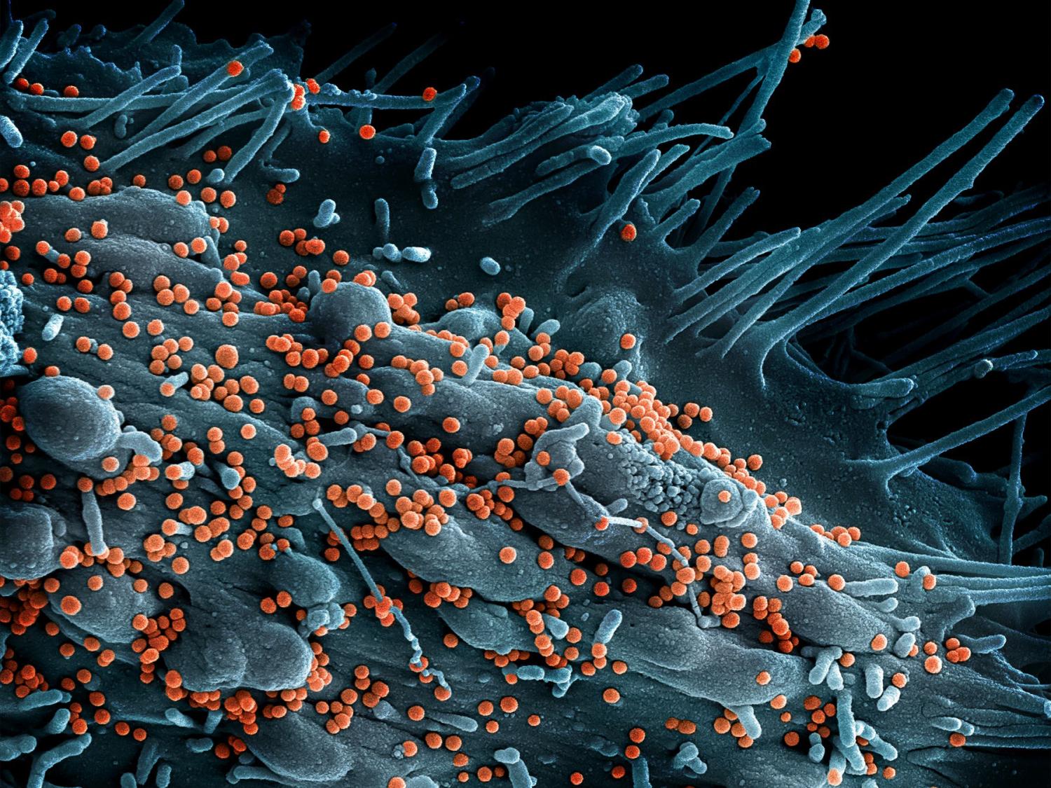 Lassa virus budding off an infected cell