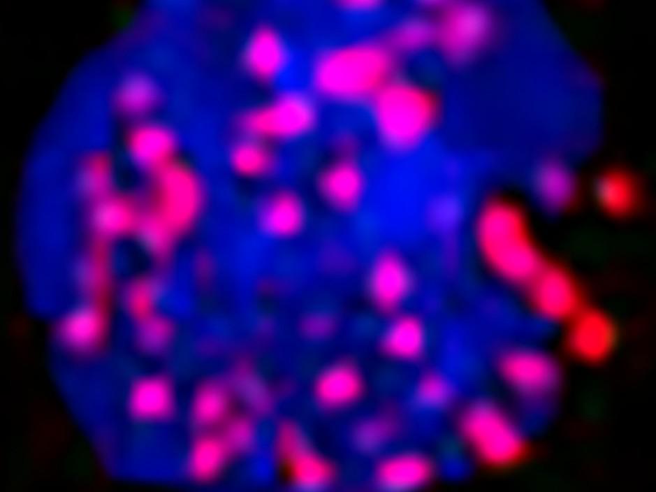Replication protein A (RPA) forms a complex with WASp at replication forks within the nucleus of a human cell during DNA replication stress.  