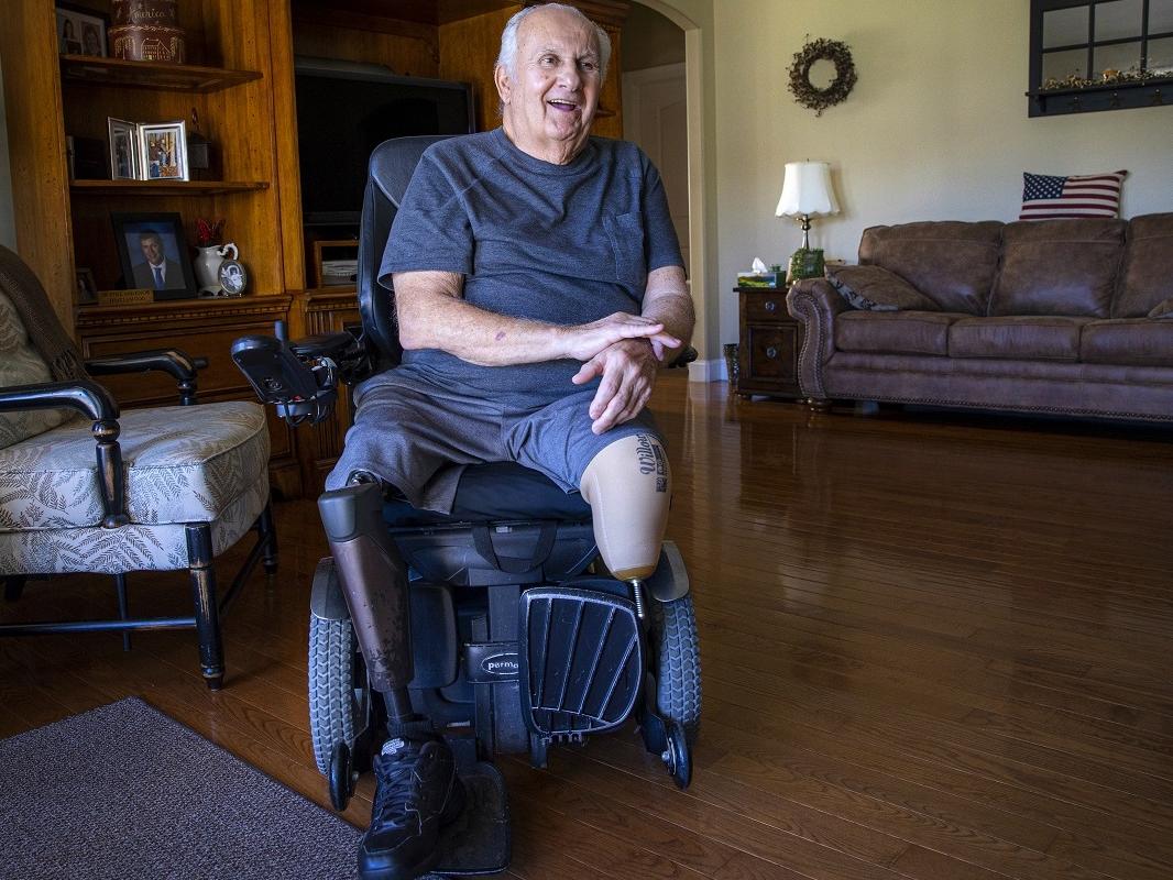 A man sits in a wheelchair a living room. His right leg is a prosthetic. His left is amputated near the knee. The man smiles and speaks.