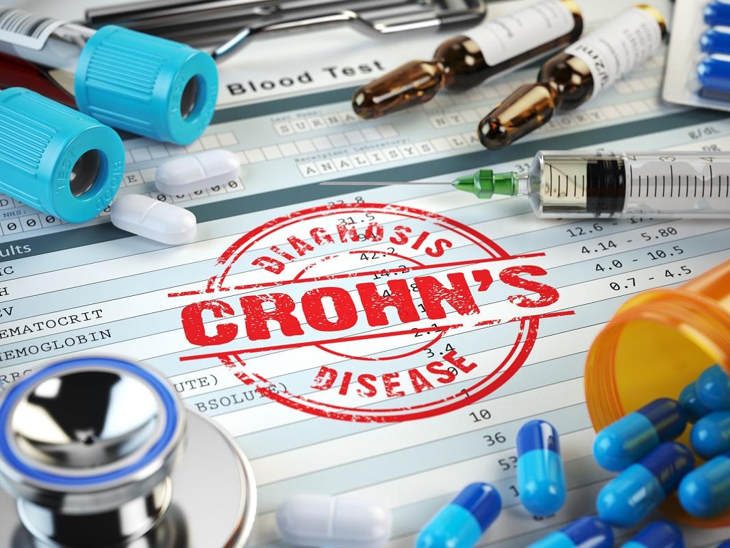 Graphic on Crohn’s disease diagnosis. Stamp, stethoscope, syringe, blood test and pills on the clipboard with medical report.