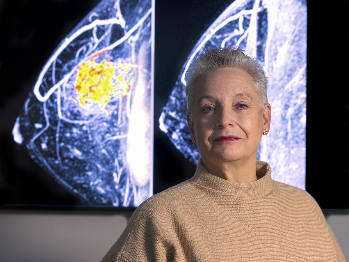 Doris Shank stands in front of x-ray images of a breast.