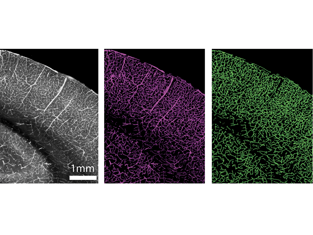 three images of the vascular network in the brain