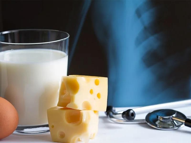image of dairy food in front of an xray 