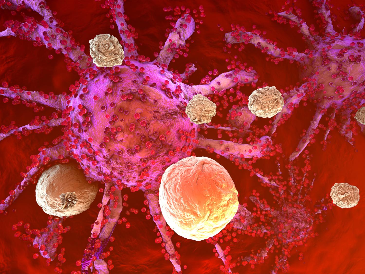 3D model of cancer cells being attacked by the immune system cells found in the body  