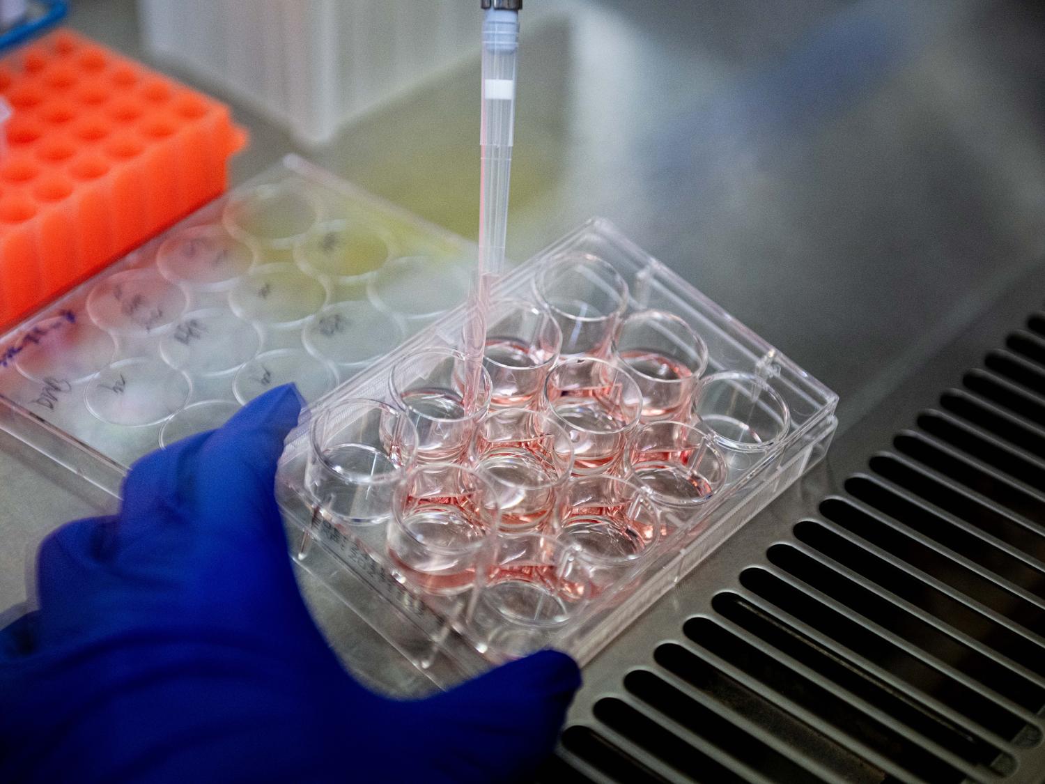 A gloved hand holds sterile containers