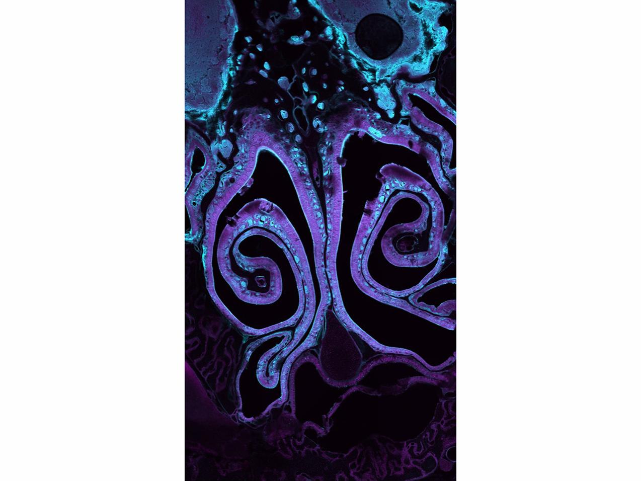 Image of a brain scan with purple swirls on a black background