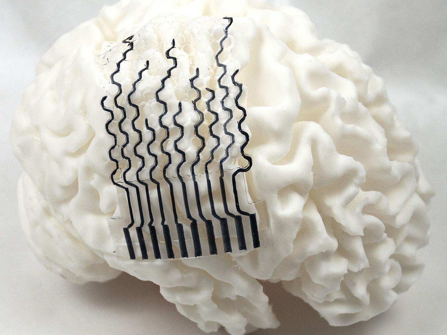 A picture of the team's bioelectrode design sitting on a 3D printed model of a patient's brain