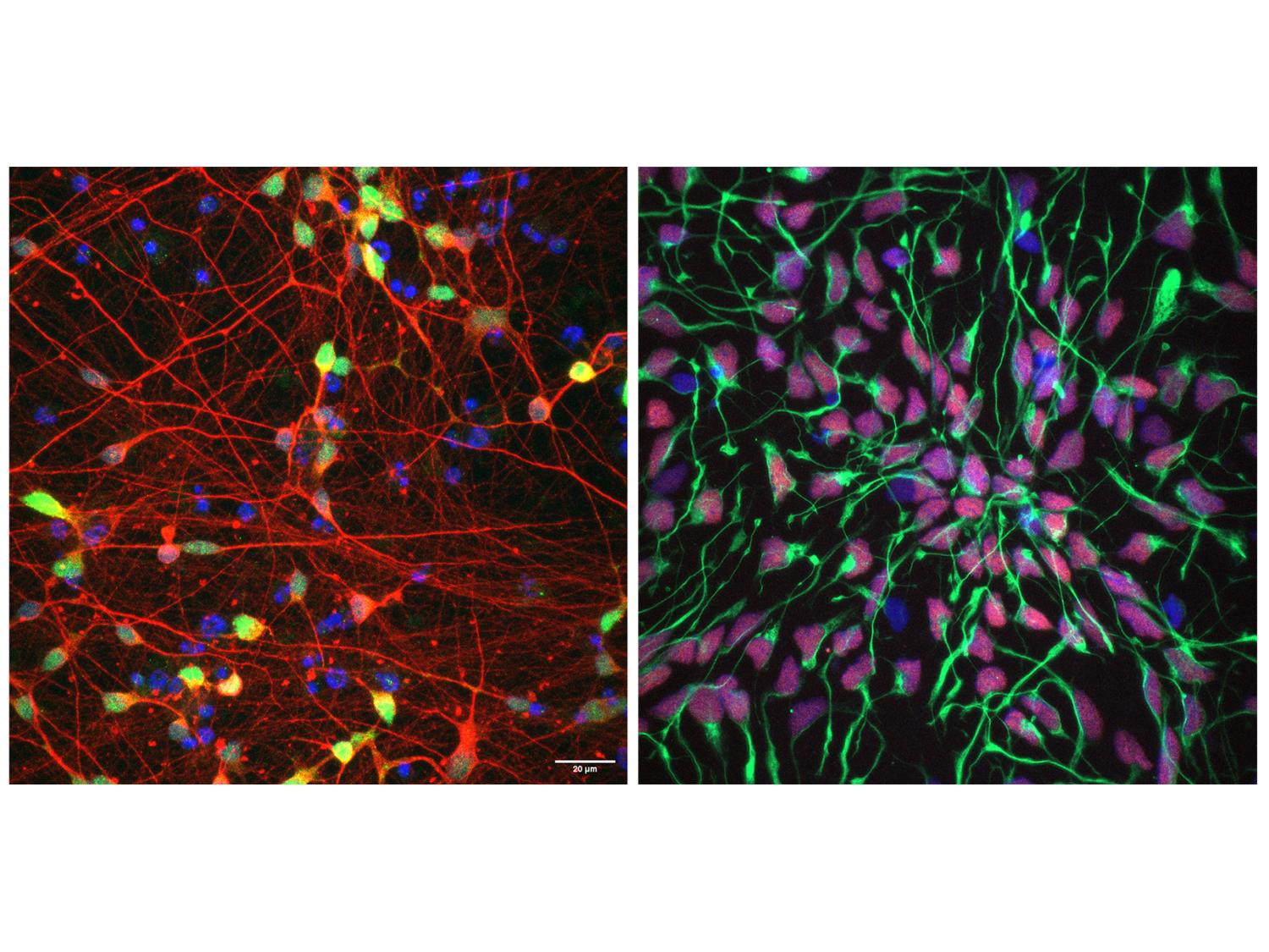 Left: cluster of neurons with long axons stained red. Right: cluster of neural progenitor cells stained green and purple