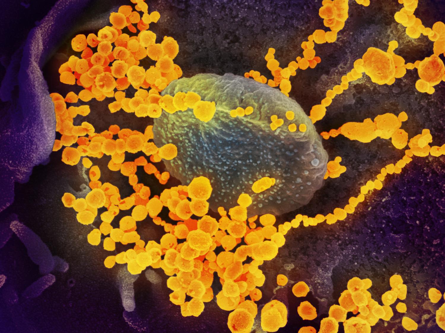 SARS-CoV-2 emerging from the surface of cells cultured in the lab