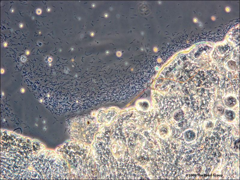 infective sporozoites