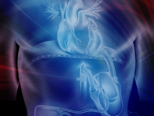 Illustration of an artificial heart inside a man's chest