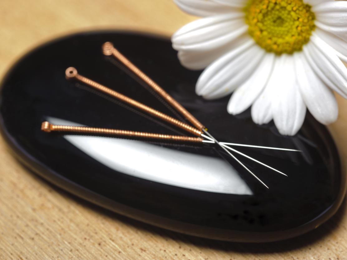 acupuncture needles