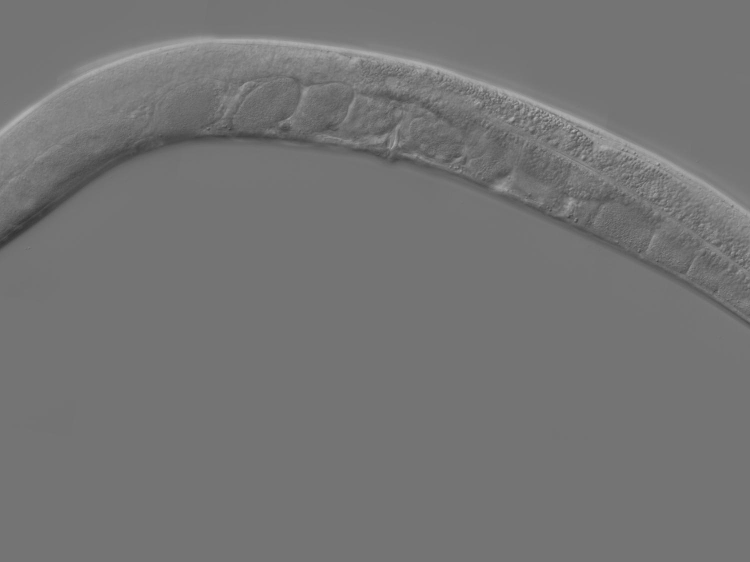 An adult C. elegans worm