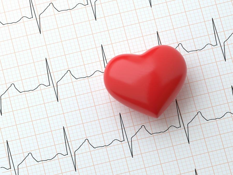 Heart on electrocardiogram that shows heart rhythm.