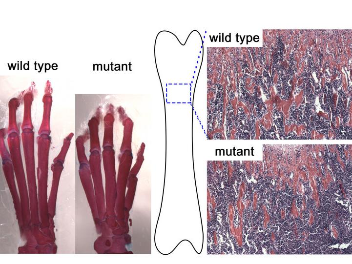 Bone development regulator phenotype