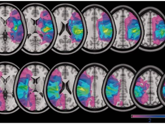 brain scan series